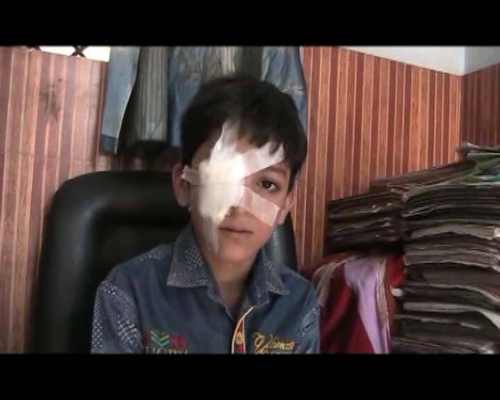 Student Losing Eyeside With Teachers Slap In Muzzafarnagar मुज़फ्फरनगर में टीचर के थप्पड़ से गई बच्चे की आंख की रौशनी