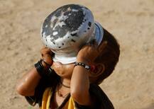 बच्चों में कुपोषण की उच्च दर में भारत आगे