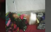 यूपी में अस्पताल की लापरवाही: ऑपरेशन के बाद पेट में छोड़ी कैंची, महिला की मौत