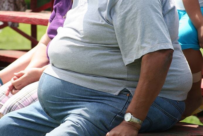 Obesity: Be aware of these complications मोटापे से जूझ रहे लोगों को हो सकती हैं हेल्थ संबंधी ये समस्याएं
