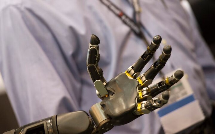 Bionic hand with sense of touch can be worn outside the lab महिला को आर्टिफिशयल हाथ से मिली स्पर्श की अनुभूति