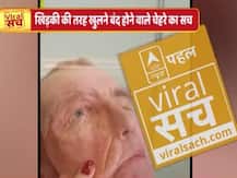 जानिए खिड़की की तरह खुलने वाले चेहरे का वायरल सच