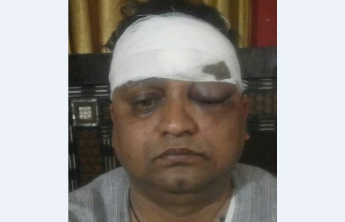 Journalist attacked in Lucknow, two arrested लखनऊ: रोडरेज में वरिष्ठ पत्रकार नवलकांत सिन्हा पर जानलेवा हमला, दो गिरफ्तार