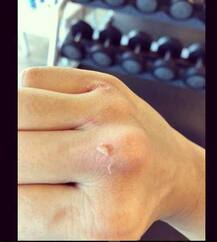 \'सुनो ना संगमरमर\' गाने की फेम एक्ट्रेस फेम नेहा शर्मा को लगी चोट 