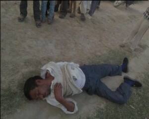 सांप ने किसान को काटा तो वह खा गया सांप का फन, फिर भी है बिल्कुल ठीक!