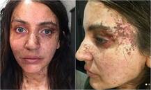 \'परी\' के लिए अनुष्का शर्मा का हुआ था ऐसा मेकअप, अब सामने आई तस्वीरें