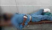 लखनऊ में डॉक्टर की बड़ी लापरवाही, घायल मरीज के कटे पैर को बना दिया तकिया