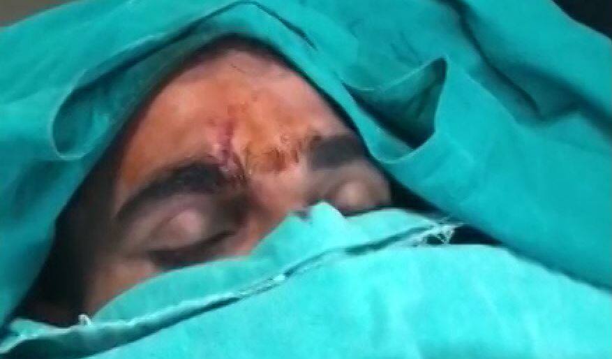 क्रिकेटर मोहम्मद शमी सड़क हादसे में घायल, सिर में लगे 10 टांके, अब आराम कर रहे हैं