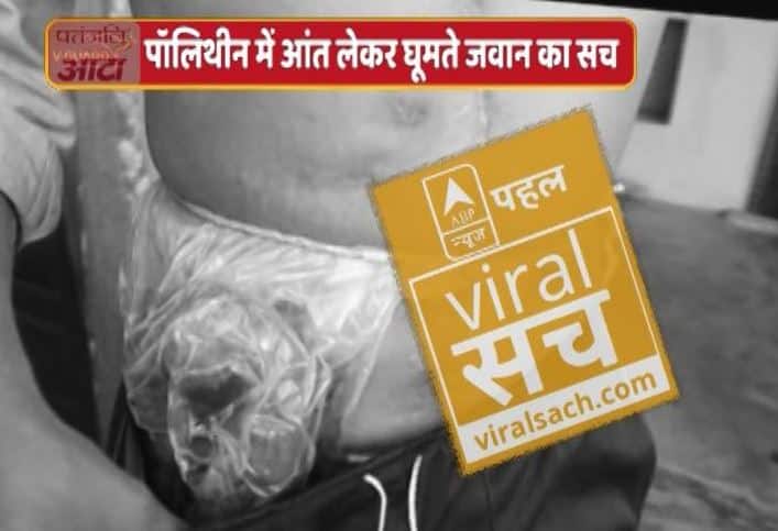 अपनी आंत पॉलीथीन में बांधकर घूमने वाले CRPF जवान का वायरल सच
