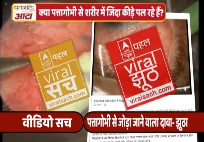 पत्तागोभी खाने से आंख में कीड़े पड़ने का वायरल सच