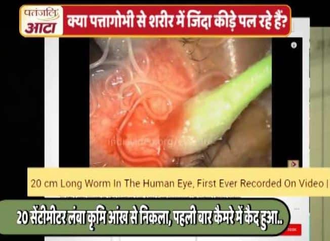 पत्तागोभी खाने से आंख में कीड़े पड़ने का वायरल सच