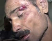 उन्नाव कांड: पीड़िता के पिता की मौत मामले में सीएमएस सहित 2 निलंबित