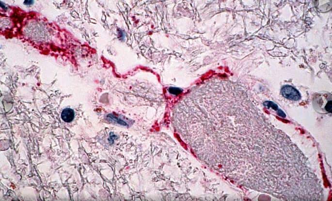 केरल के स्वास्थ्य अधिकारियों ने इस बात की पुष्टि की है कि घातक निपाह वायरस से कई लोगों की मौत हुई है. कुछ मरीजों में ये वायरस पॉजिटिव आया  है. वहीं कई लोग इस वायरस के कारण कोझिकोड के हॉस्पिटल में भर्ती हैं. फोटोः गूगल फ्री इमेज 