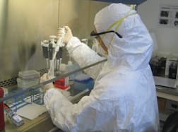 કેરળમાં 12 વર્ષના બાળકનો ભોગ લેનારા ખતરનાક નિપા વાયરસનો કઈ રીતે લાગે છે ચેપ ? શું હોય છે લક્ષણો ?