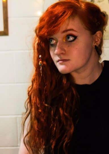 दरअसल, लुना हॉस्पिटल में डॉक्टर्स का इंतजार करते-करते अपनी सेल्फी खींचने लगी. जब डॉक्टर्स लुना को देखने आए तो लुना को सेल्फीलेता देख डॉक्टर्स को लगा वो नशे में है.फोटोः फेसबुक