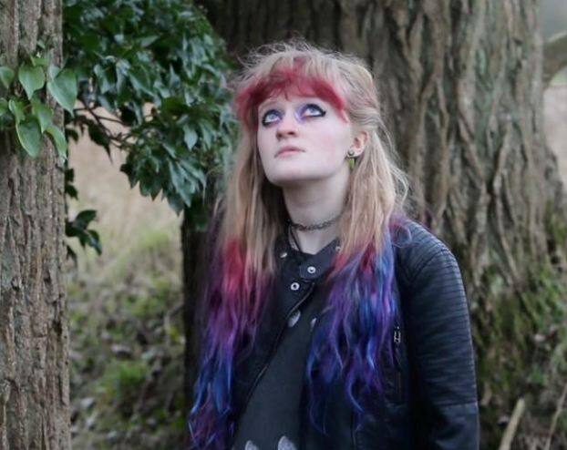 अब लुना जिंदगी भर दवाओं के सहारे जीएगी. हालांकि उनका ब्रेन लंबे समय तक सामान्य नहीं हो पाएगा. फोटोः फेसबुक