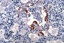 निपाह वायरसः केरल जाने से बचें, जाना चाहते भी हैं तो इन जगहों पर बिल्कुल ना जाएं