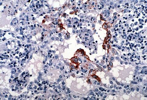 निपाह वायरसः केरल जाने से बचें, जाना चाहते भी हैं तो इन जगहों पर बिल्कुल ना जाएं