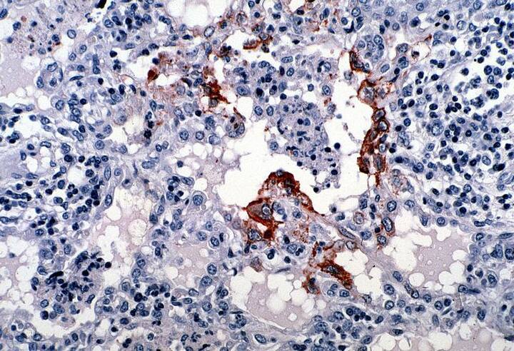 किन्हीं वजहों से अगर आप केरल जा भी रहे हैं तो निपाह वायरस से प्रभावित क्षेत्रों से दूर रहें. फोटोः गूगल फ्री इमेज 