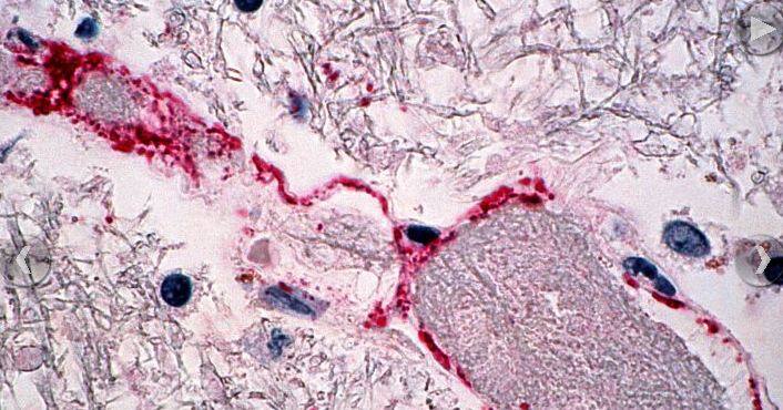 निपाह बुखार से मरने वाले किसी भी व्यक्ति के मृत शरीर को ले जाते समय चेहरे को ढंकना महत्वपूर्ण है.फोटोः गूगल फ्री इमेज