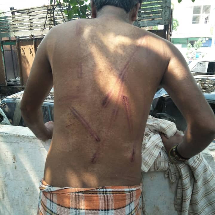 blusterer brutally beaten the youth in Kanpur मामूली सी बात पर दबंगों ने युवक को दी खौफनाक सजा, उभर आए गहरे जख्म