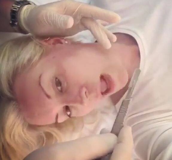 डेनिस ने चेहरे का भी ट्रीटमेंट लिया है. फोटोः इंस्टाग्राम