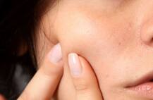 इस समस्या के लिए आप भी करते हैं टूथपेस्ट का इस्तेमाल, तो हो जाएं सावधान