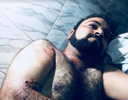 डॉक्टर कफील के भाई कासिफ को जान से मारने की नीयत से फायर करने वाले शूटरों की तलाश तेज हो गई है. पुलिस ने होटल संचालक समेत कई शिकंजे में हैं. पुलिस का दावा है कि जल्द ही शूटरों को गिरफ्तार कर मामले का पर्दाफाश कर सकती है. डा. कफील का भाई कासिफ प्रॉपर्टी डीलिंग का काम करता है. बताया जा रहा है कि होटल व्यापारी से ही कासिफ का जमीन और रुपए के लेनदेन को लेकर विवाद चल रहा है.
