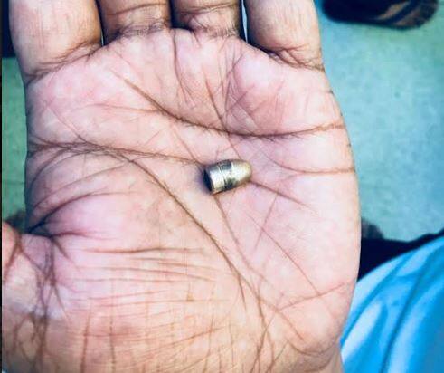 कासिफ जमील रविवार की रात में गोरखनाथ से बसंतपुर मुहल्ले में स्थित अपने घर बाइक से अकेले जा रहे थे. कोतवाली क्षेत्र के गोरखनाथ पुल के करीब जेपी हास्पिटल के पास वाली गली में वे पहुंचे थे, कि भूरे रंग की स्‍कूटी सवार अज्ञात हमलावरों ने उनको ओवरटेक किया. अभी वह कुछ समझ पाते कि उन पर ताबड़तोड़ तीन फायर झोंक दिए. एक हमलावर हेलमेट और दूसरा गमछा बांधे हुए था. जब पुलिस ने सीसीटीवी फुटेज खंगाला तो उसमें बहुत साफ तस्‍वीर सामने नहीं आई.