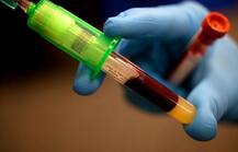 Blood Bank of Maharashtra requests to donate blood