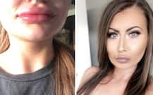 होंठो पर सूजन आने पर लड़की ने डॉक्टर को ठहराया दोषी, डॉक्टर ने कहा सेक्स के कारण हुआ ऐसा