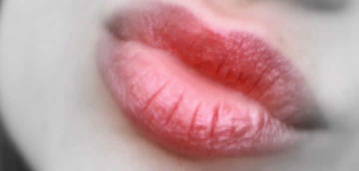  बहरहाल, चार्लोट अभी क्लीनिक से अपने हक की लड़ाई लड़ रही है लेकिन वे इस बात से दुखी हैं कि उनका चेहरा बिगड़ गया है. फोटोः गूगल फ्री इमेज 