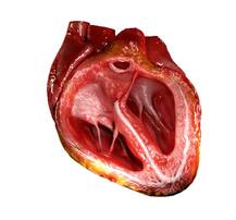 इस तरह ढाई घंटे में धड़कता दिल मुंबई से दिल्ली पहुंचा ढाई घंटे में