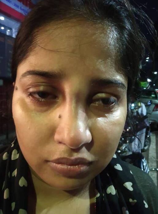 पुलिसिया डंडे से लड़की की नाक टूटी, योगी ने दिए जांच के आदेश Lucknow: A girl's nose broken when police throw stick on her पुलिसिया डंडे से लड़की की नाक टूटी, योगी ने दिए जांच के आदेश