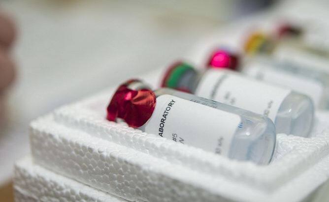  लेकिन अब तीन साल बाद स्टेफर्ड ने एक अन्य डॉक्टर की सलाह पर HIV टेस्ट करवाया जो ना सिर्फ पॉजिटिव पाया गया बल्कि स्टेफर्ड को एड्स होने का   खतरा भी बढ़ गया है. फोटोः गूगल फ्री इमेज 