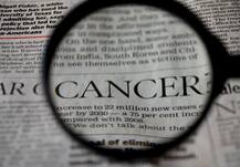 कैंसर के प्रसार का पता लगाने के लिए वैज्ञानिकों ने विकसित की नई विधि