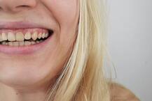 दांतों से जुड़े इन मिथ्स पर भूलकर भी ना करें भरोसा, दांत हो सकते हैं खराब