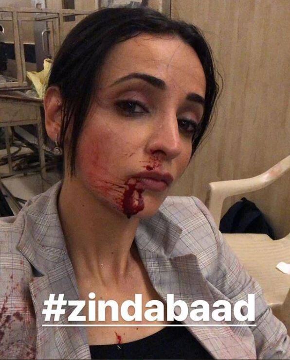 टीवी अभिनेत्री सनाया ईरानी के नाक से निकला 'खून', डायरेक्टर को बताया 'जिम्मेदार