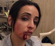 टीवी अभिनेत्री सनाया ईरानी के नाक से निकला \'खून\', डायरेक्टर को बताया \'जिम्मेदार\'