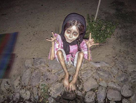 सहर ने एंजेलिना जोली जैसा बनने के लिए 50 कॉस्मेटिक सर्जरी करवाईं लेकिन बाद में इस ट्रीटमेंट को बीच में ही रोक दिया. फोटोः इंस्टाग्राम