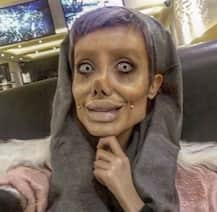 खुद को एंजेलिना जोली बोलने वाली इस लड़की की तस्वीरें देख आप भी डर जाएंगे