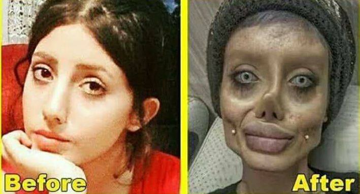 आप सहर की सबसे पहले बिना सर्जरी की तस्वीर देखेंगे तो दंग रह जाएंगे. सहर पहले की इन तस्वीरों में बेहद खूबसूरत लग रही हैं. फोटोः फेसबुक