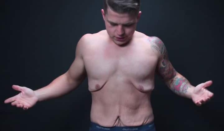 इसके साथ ही वजन और मांसपेशियां घटने लगती है. तस्वीर: गूगल फ्री इमेज