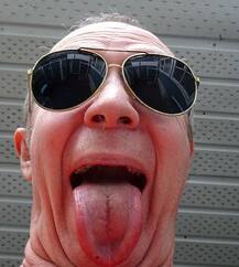 हैरतअंगेज, इस महिला की जीभ पर जब अचानक आने लगे बाल