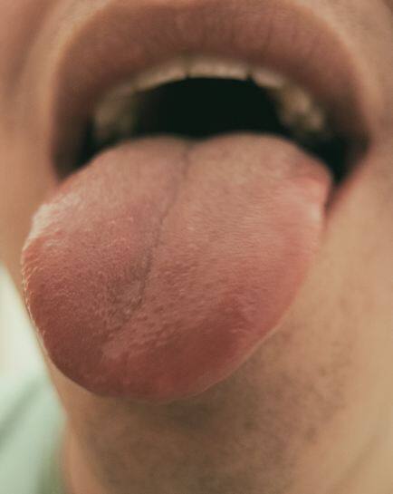 कई बार ये स्थिति खराब ओरल केयर, ड्राई माउथ, टोबैको, बहुत ज्यादा एल्‍‍कोहल का सेवन करने से भी हो सकती है. फोटोः गूगल फ्री इमेज 