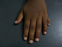 दुनियाभर में 5% लोगों के होते हैं ये बॉडी पार्ट्स