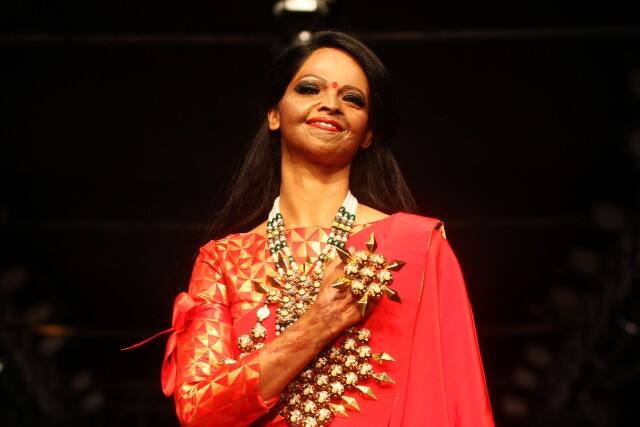 अक्षय कुमार ने फिर दिखाई दरियादिली, एसिड अटैक सर्वाइवर लक्ष्मी को दिए 5 लाख रुपए