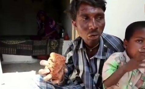 दुनिया में ऐसी बहुत सी चीजें हैं जिन्हें लोग खाते हैं लेकिन जब कोई उन चीजों के बारे में सुनता है तो यकीन नहीं कर पाता. आज हम आपको एक ऐसे शख्स से मिलवाने जा रहे हैं जो रोजाना ईंट, कंकड और मिट्टी खाने से खुद को रोक नहीं पाता. फोटोः इंस्टाग्राम 