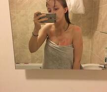 चाहकर भी नहीं रो सकती ये लड़की, खुद के आंसुओं से हैं एलर्जी