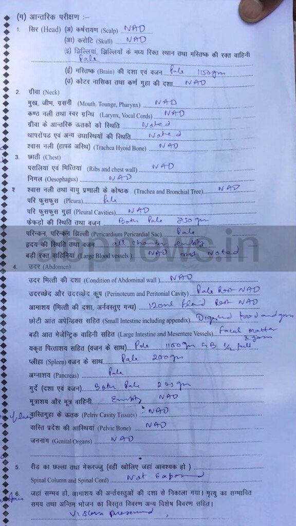 विवेक तिवारी की पोस्टमार्टम रिपोर्ट ने यूपी पुलिस को बनाया झूठा, सेल्फ डिफेंस की बात ग़लत निकली